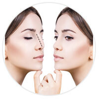 rhinoplasty-benefits-sydney rhinoplasty-benefits-sydney