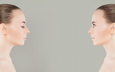 Revision Rhinoplasty Sydney: All you need to know