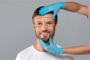 male preparing for a rhinoplasty surgery